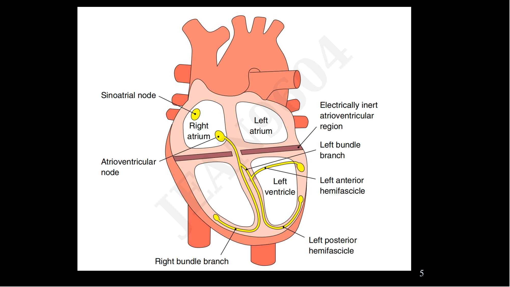 1.-memahami-aritmia-dan-interpretasi-nya-ekg-369