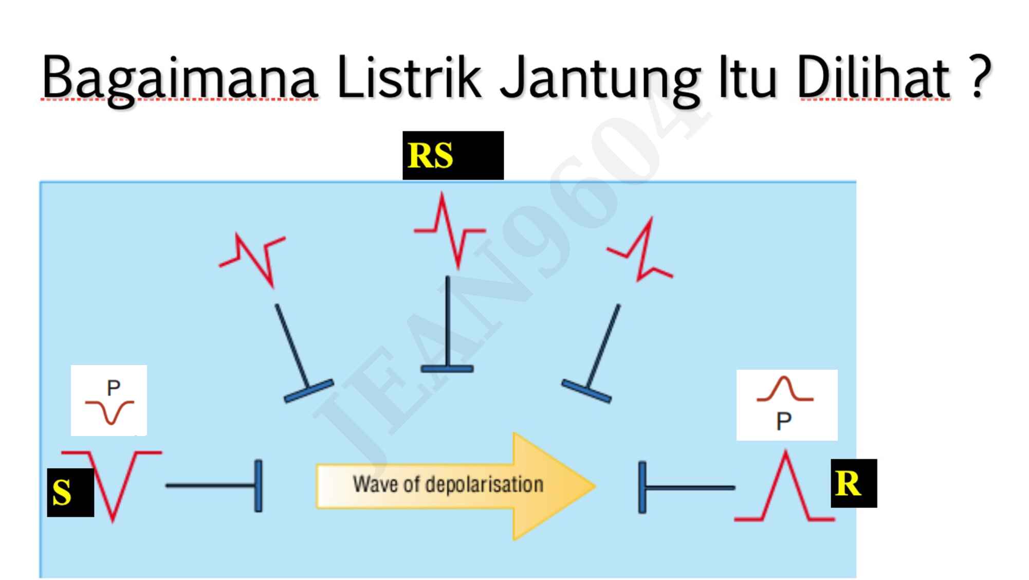 1.-memahami-aritmia-dan-interpretasi-nya-ekg-369