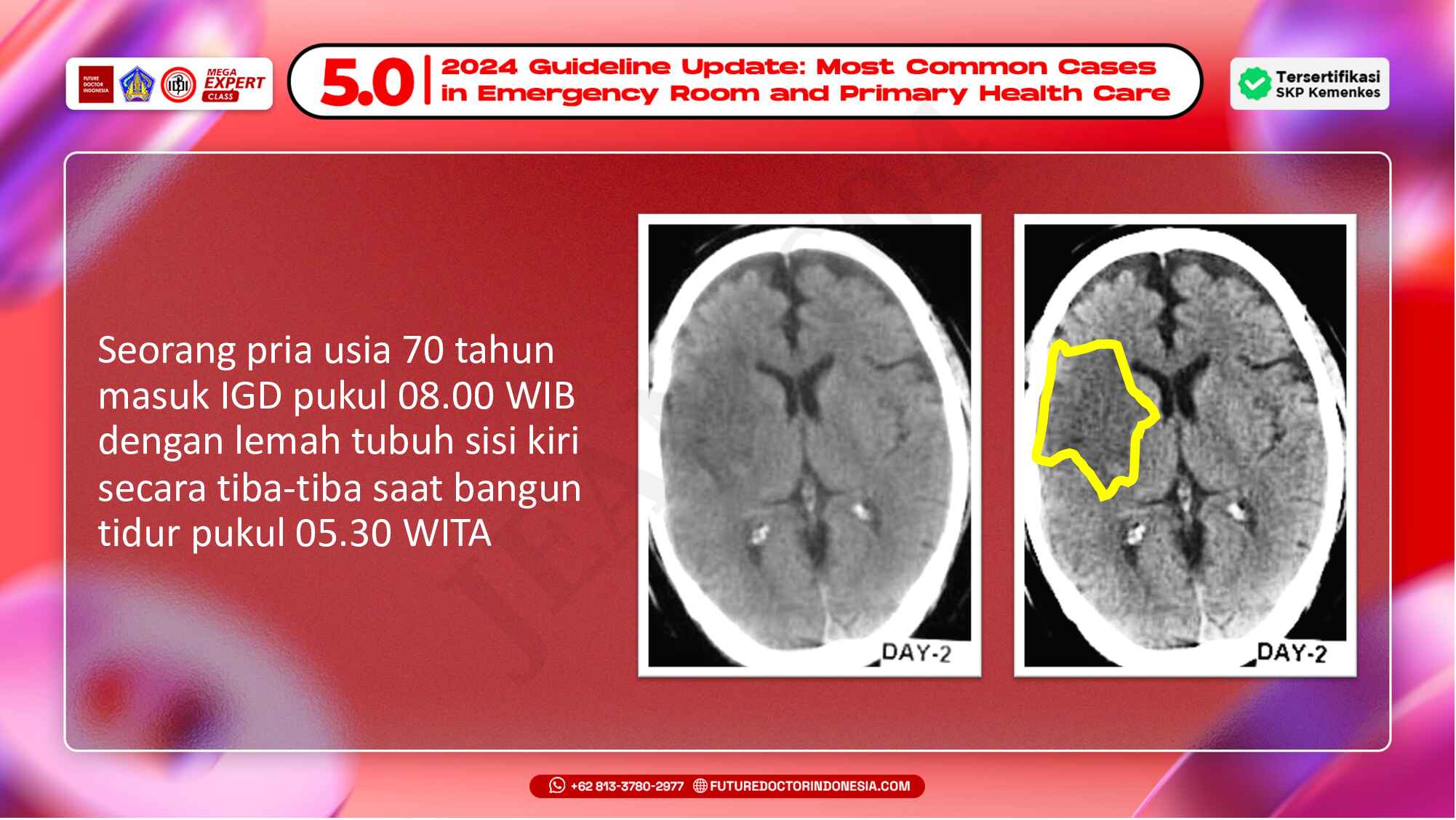 7.-pendekatan-komprehensif-stroke-di-igd-710