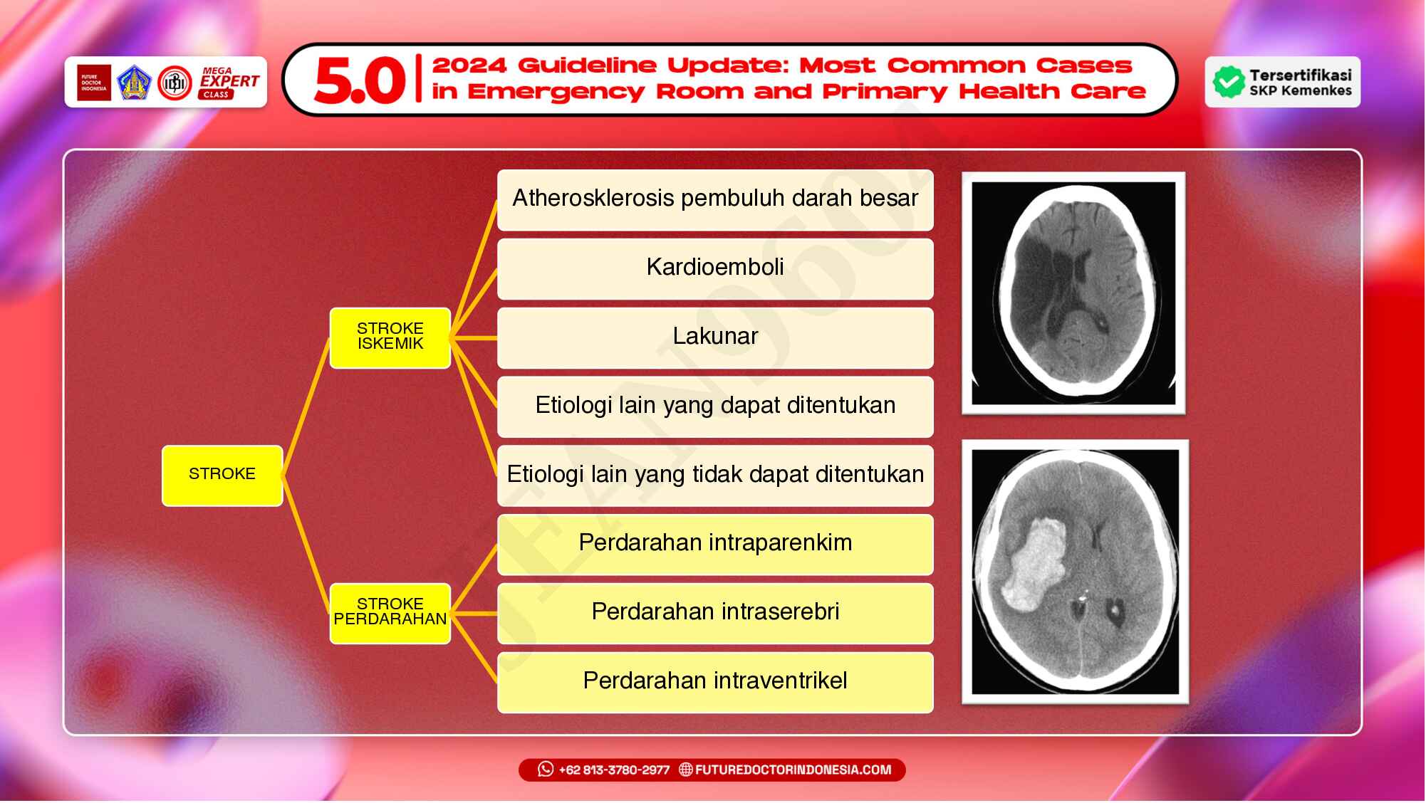 7.-pendekatan-komprehensif-stroke-di-igd-710