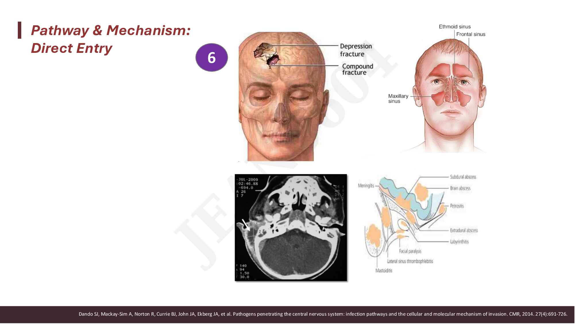 9.-pendekatan-diagnosis-dan-tatalaksana-awal-infeksi-sistem-saraf-pusat-231