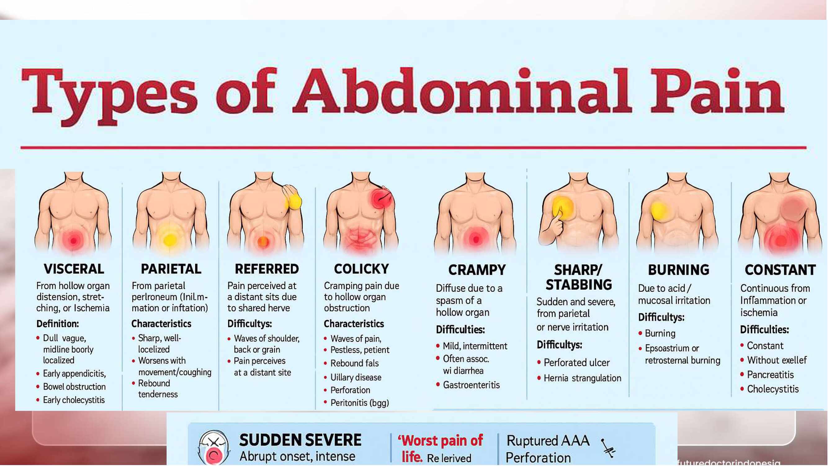 approach-to-acute-colicky-pain-from-diagnosis-to-surgical-decision-883