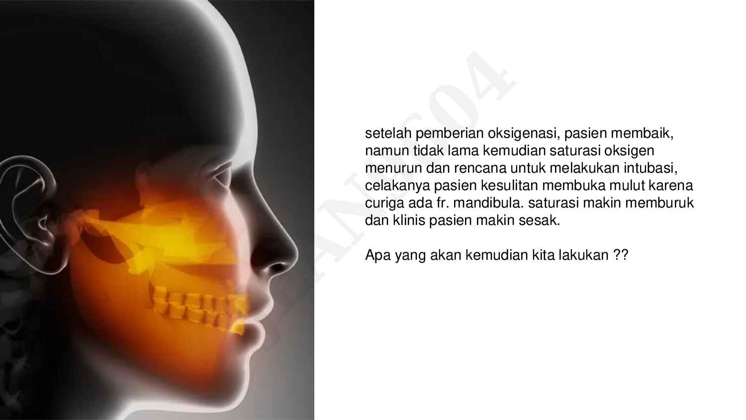 bec_emergency_life-saving_procedure___tracheostomy_&_thoracotomy_unlocked-492