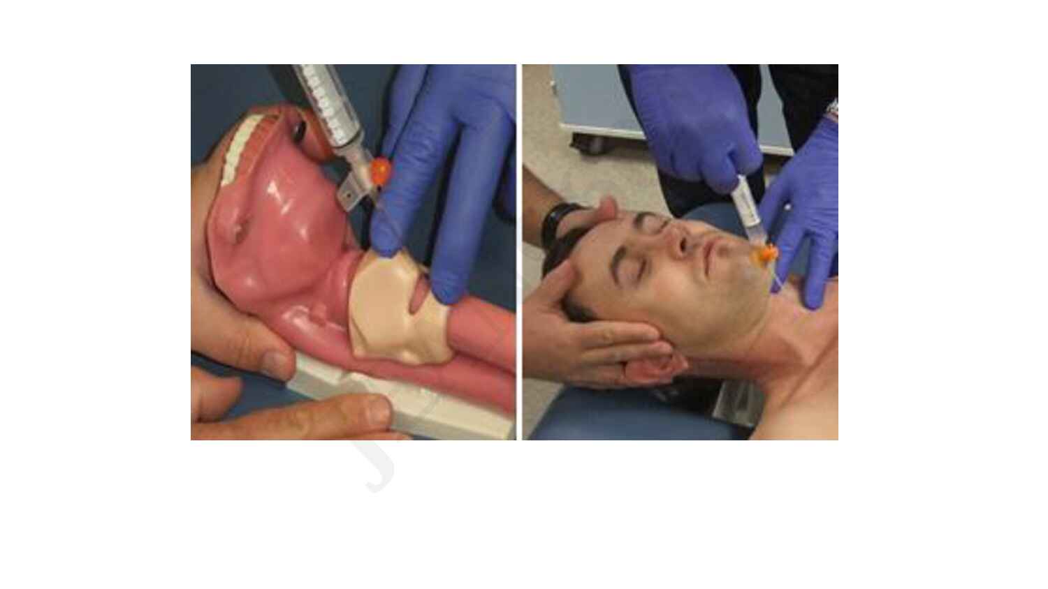 bec_emergency_life-saving_procedure___tracheostomy_&_thoracotomy_unlocked-492