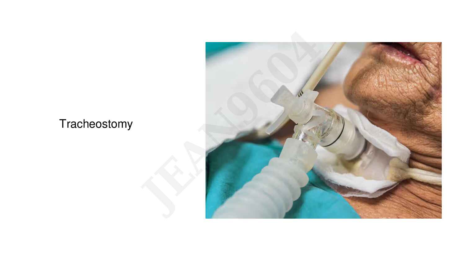 bec_emergency_life-saving_procedure___tracheostomy_&_thoracotomy_unlocked-492