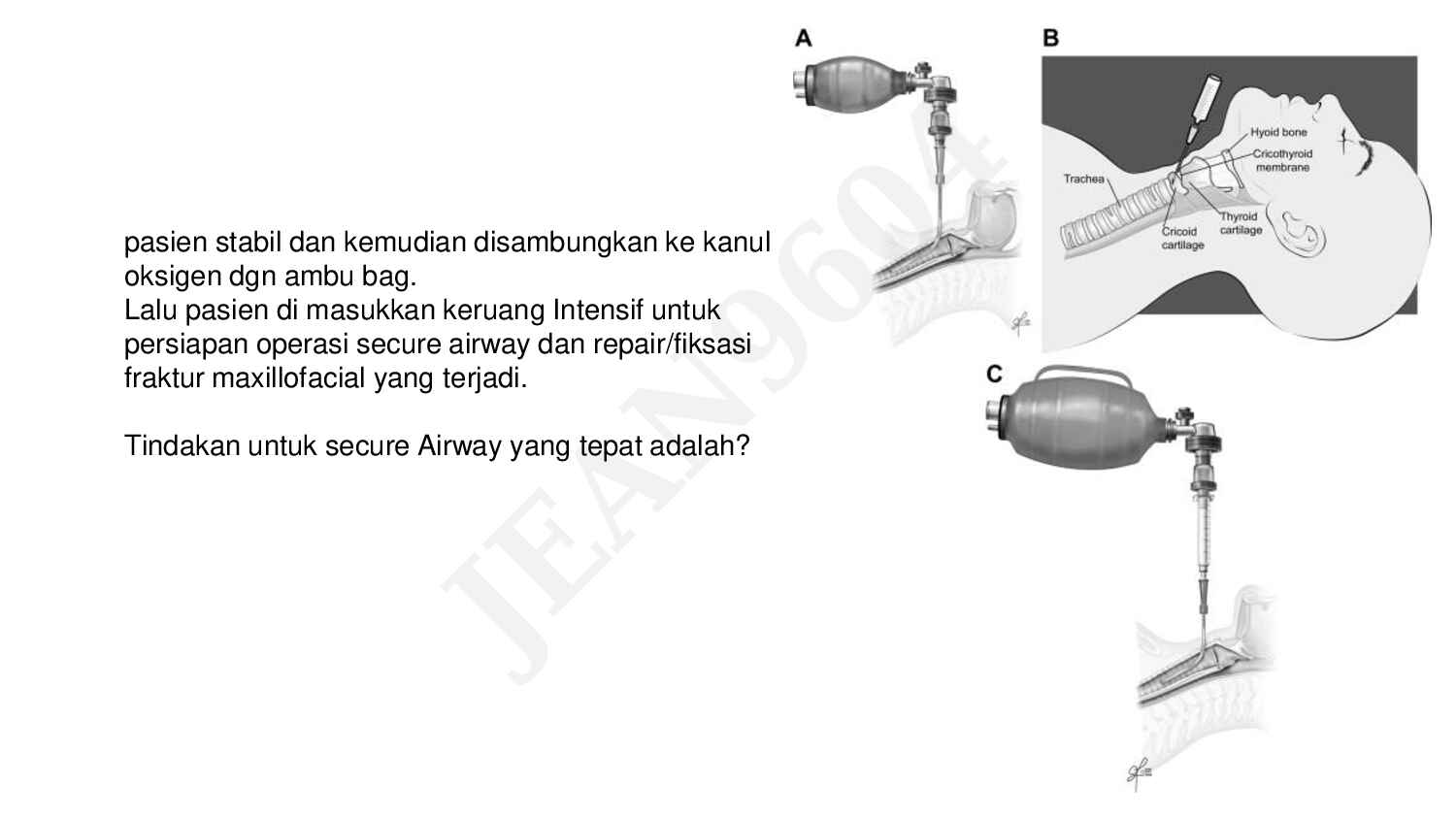 bec_emergency_life-saving_procedure___tracheostomy_&_thoracotomy_unlocked-492