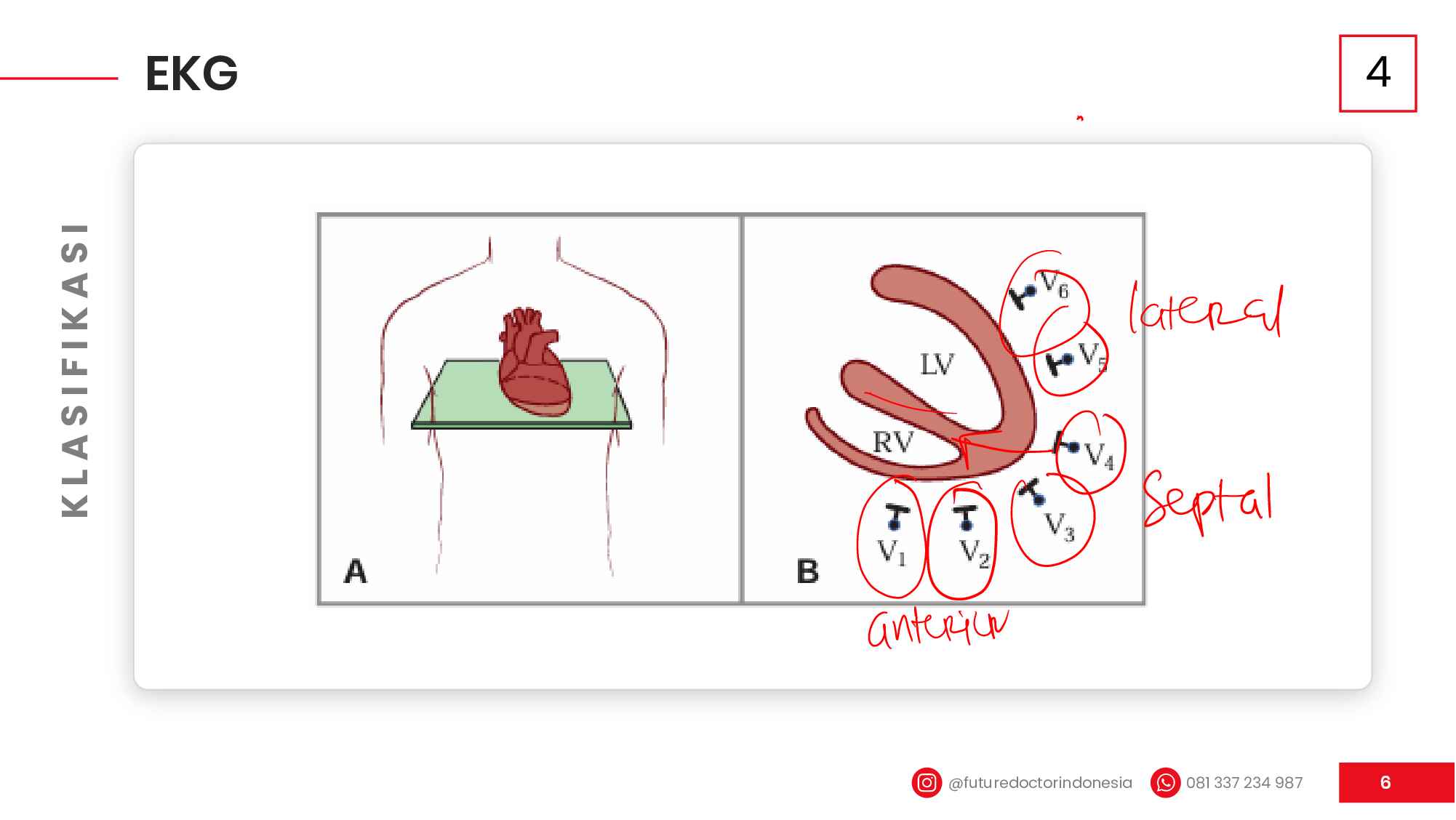 cardio-pulmo_coretan_fdi-iship-feb-2026-647