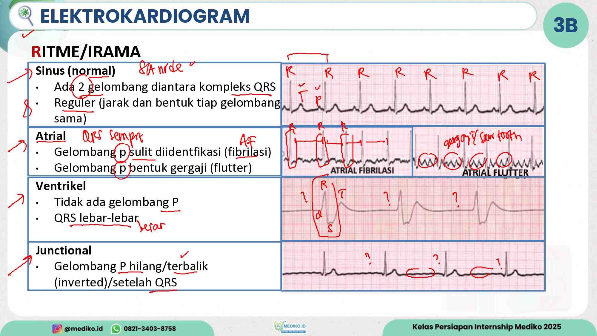 coretan-acls---dr.-hadi-430