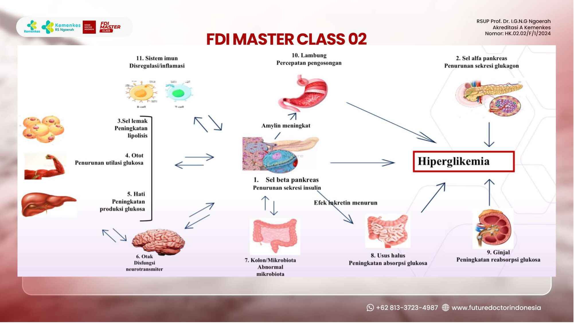 diabetes-mellitus-and-its-systemic-complication-244