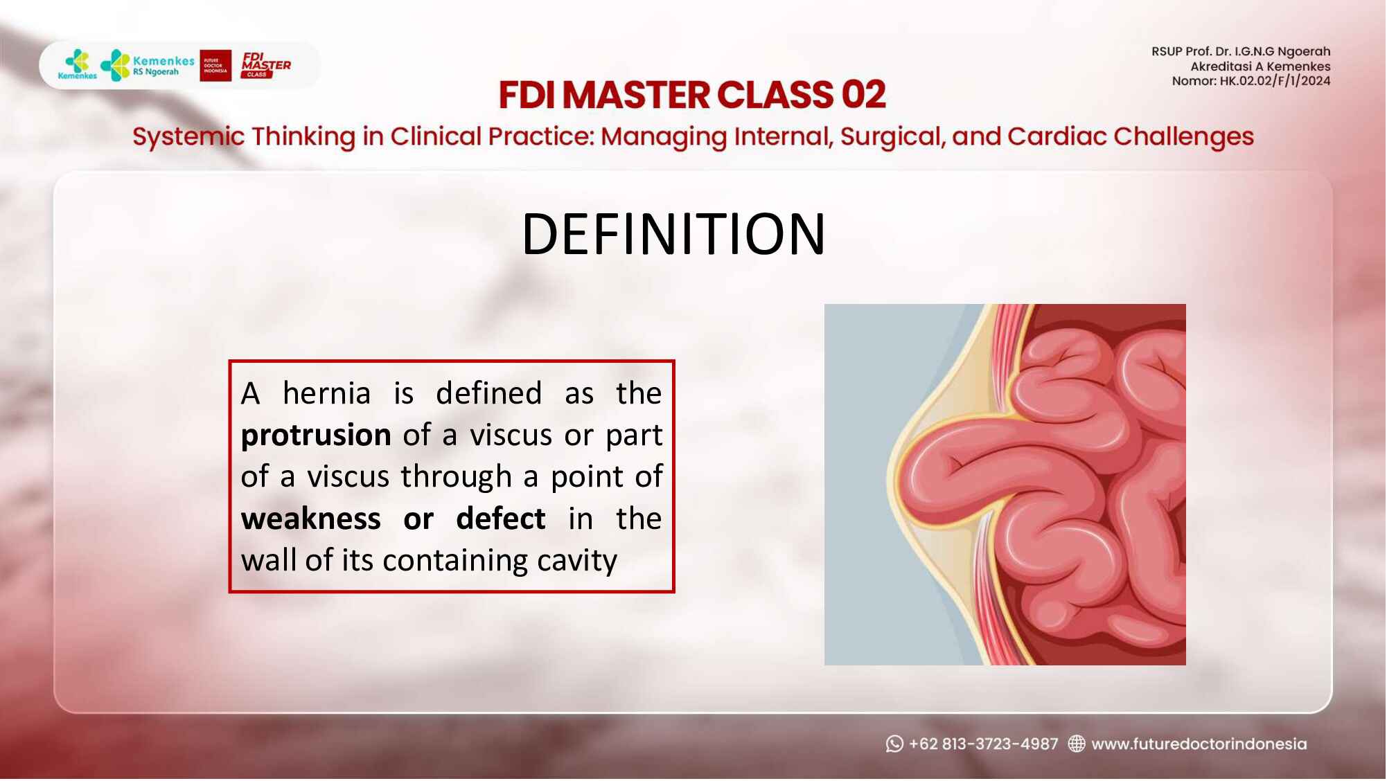hernias-demystified--types-diagnosis-and-management-principles-448