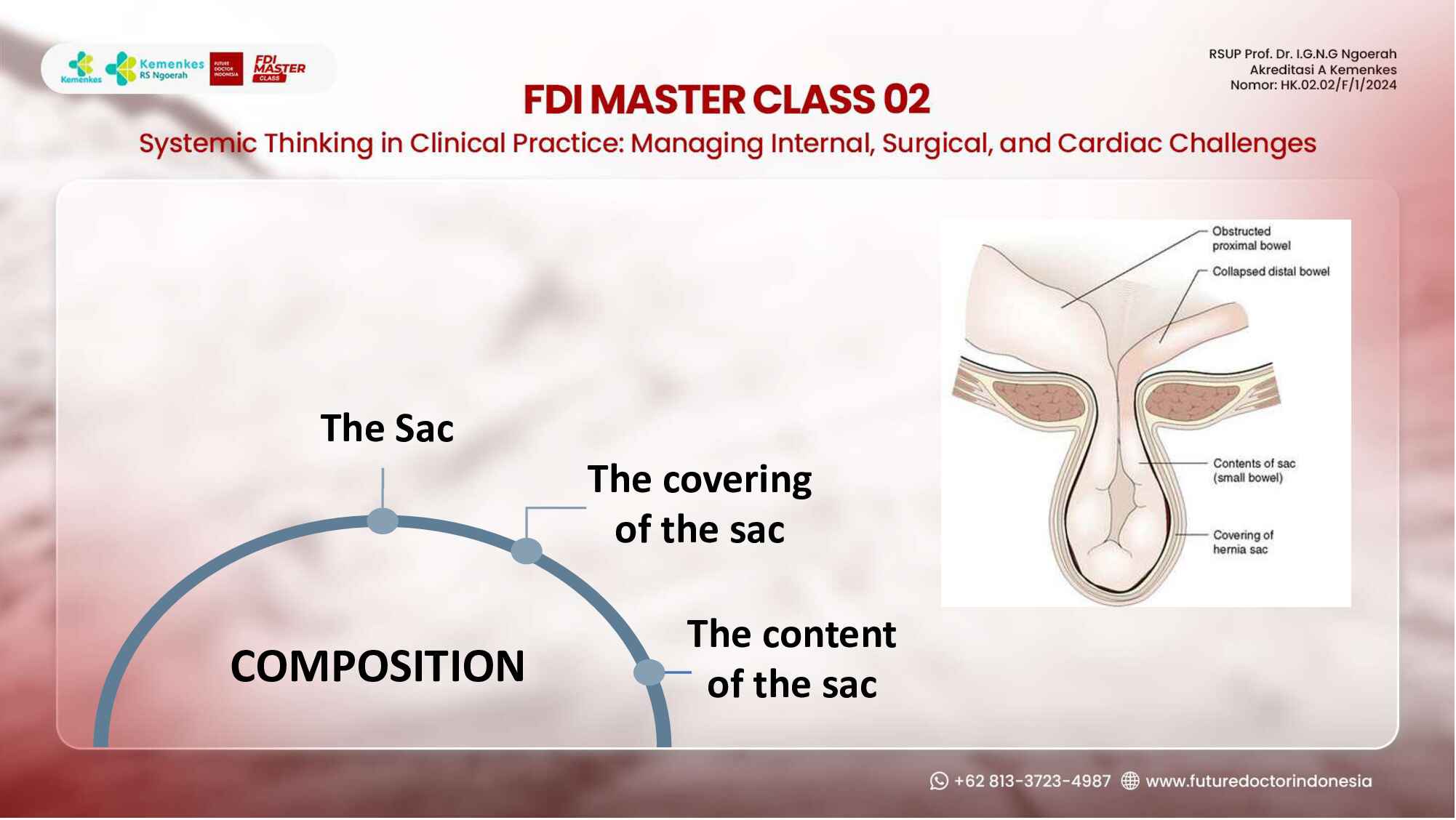 hernias-demystified--types-diagnosis-and-management-principles-448