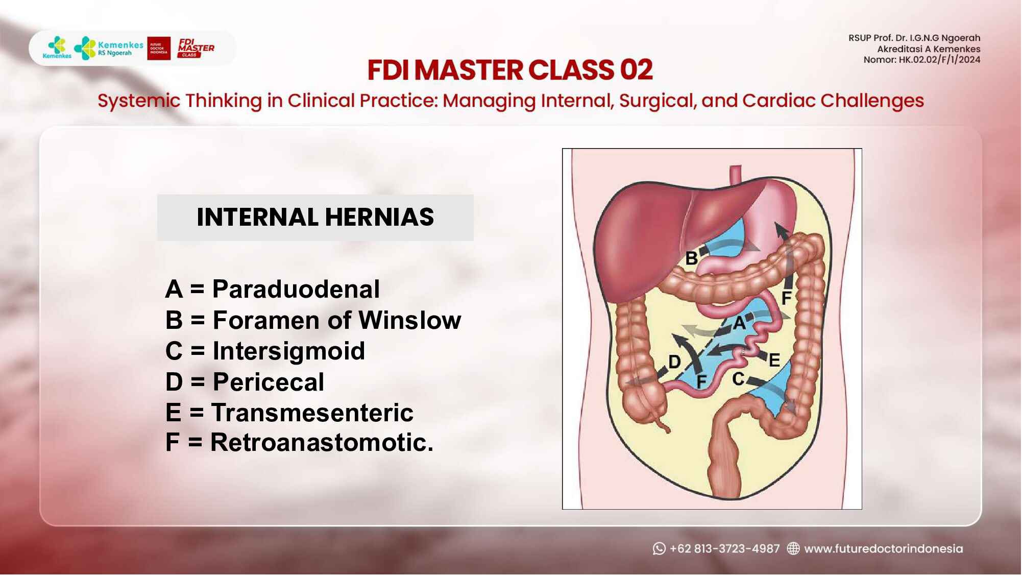 hernias-demystified--types-diagnosis-and-management-principles-448