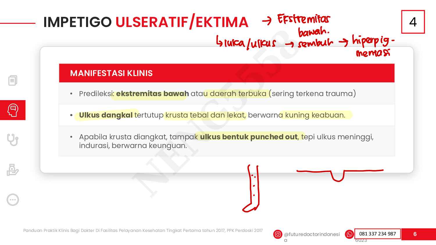 kulit-coret-535