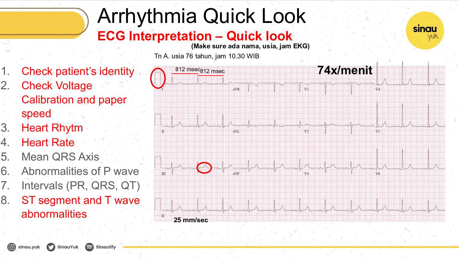 sinau-ekg-day-2-808