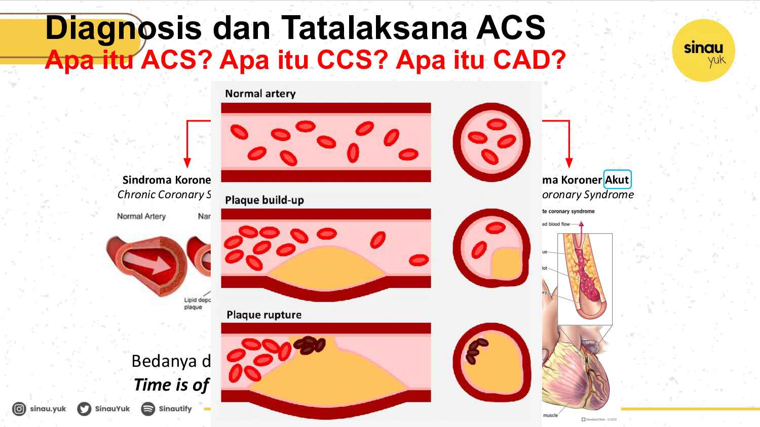 sinau-ekg-day-4-722