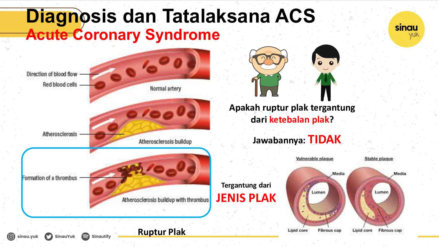 sinau-ekg-day-4-722
