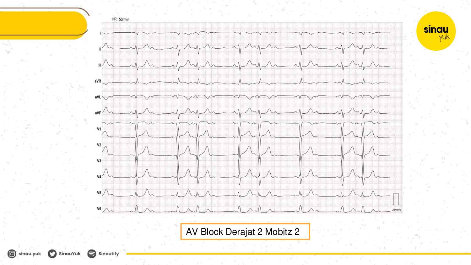 sinau-ekg-day-5-283