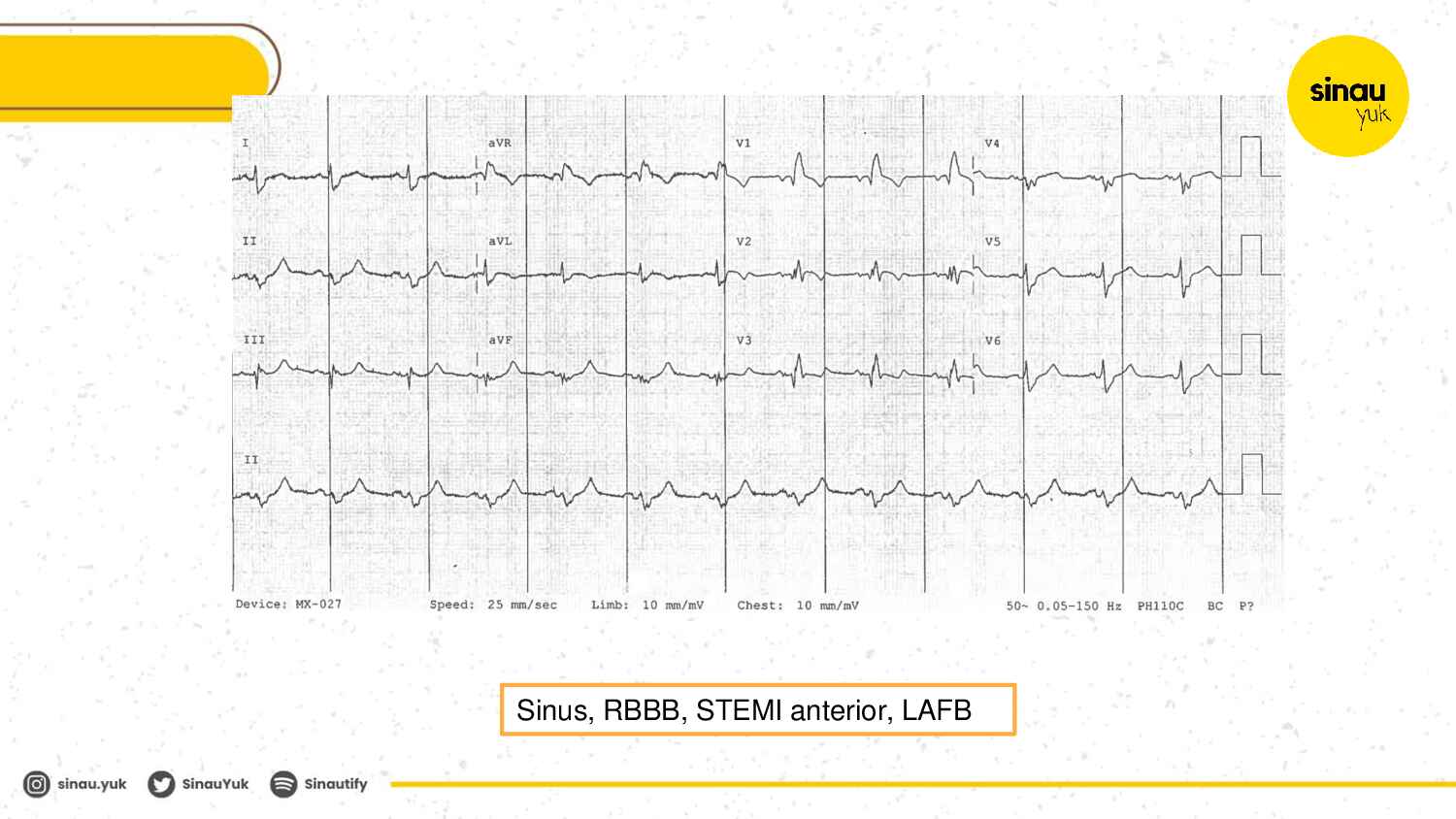 sinau-ekg-day-5-283