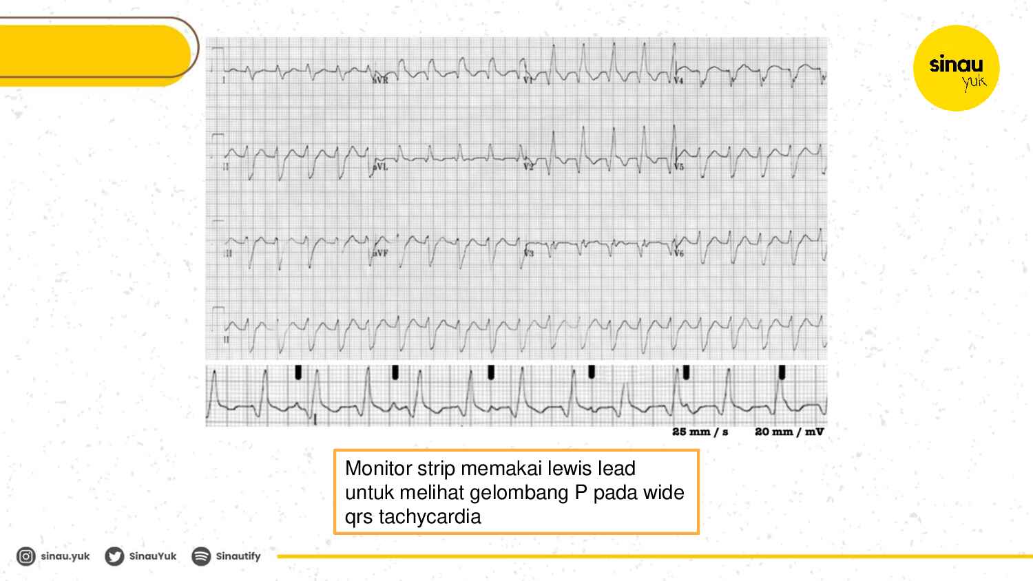 sinau-ekg-day-5-283