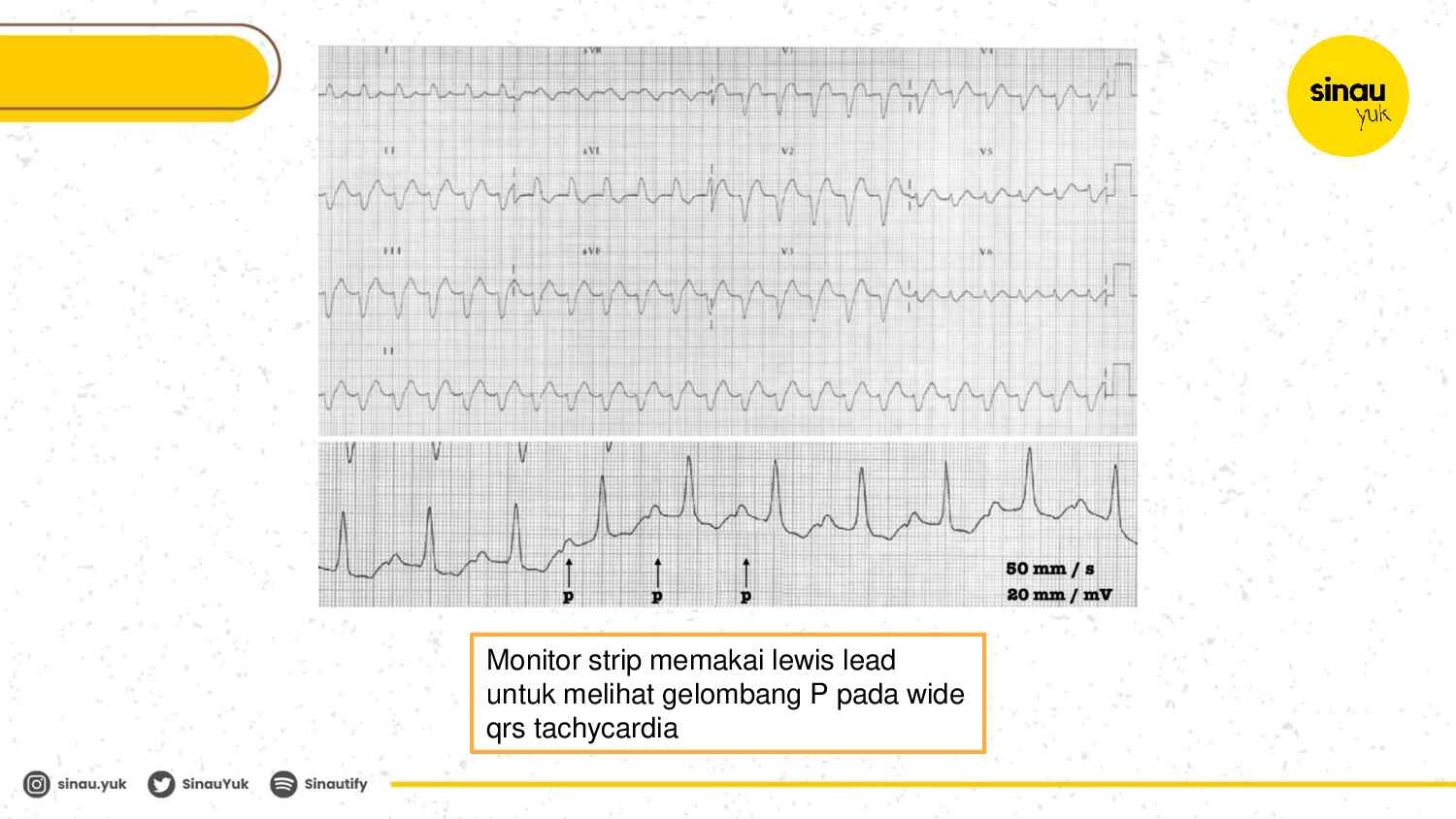 sinau-ekg-day-5-283