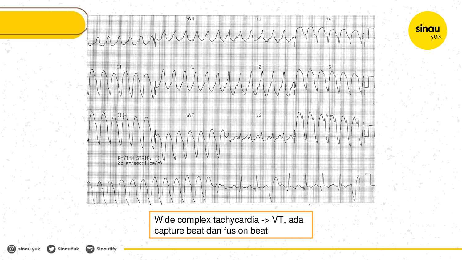 sinau-ekg-day-5-283